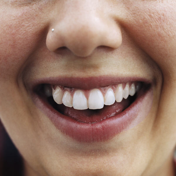 Strahlendes Lächeln nach ästhetischer Zahnbehandlung in Hamburg-Wandsbek – jetzt Beratung anfragen