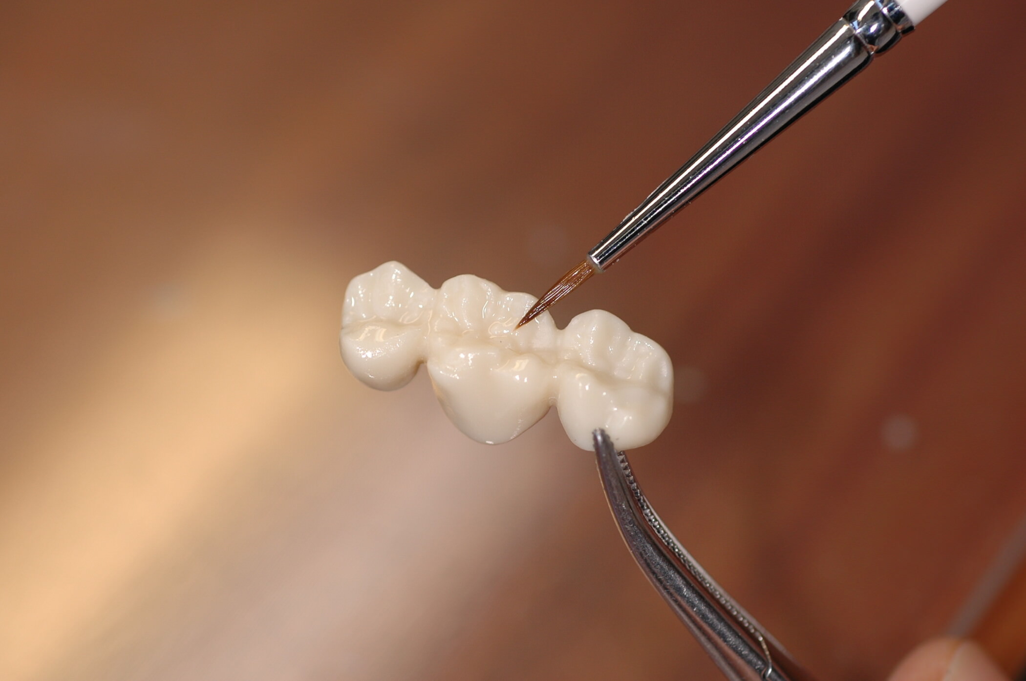 Prothetik 2 Leistungen