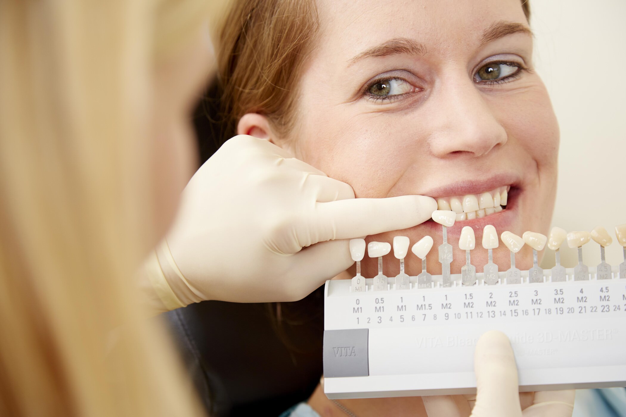 Bleaching 2 Leistungen