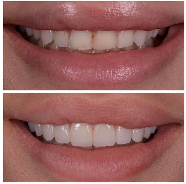 Schöne Zähne 7 Leistungen