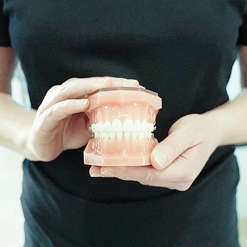 Füllungen 2 Leistungen